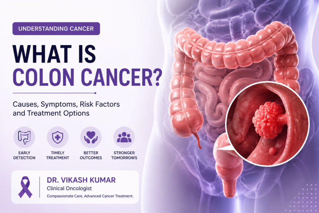 What Is Colon Cancer? Symptoms, Causes, Risk Factors, and Treatment