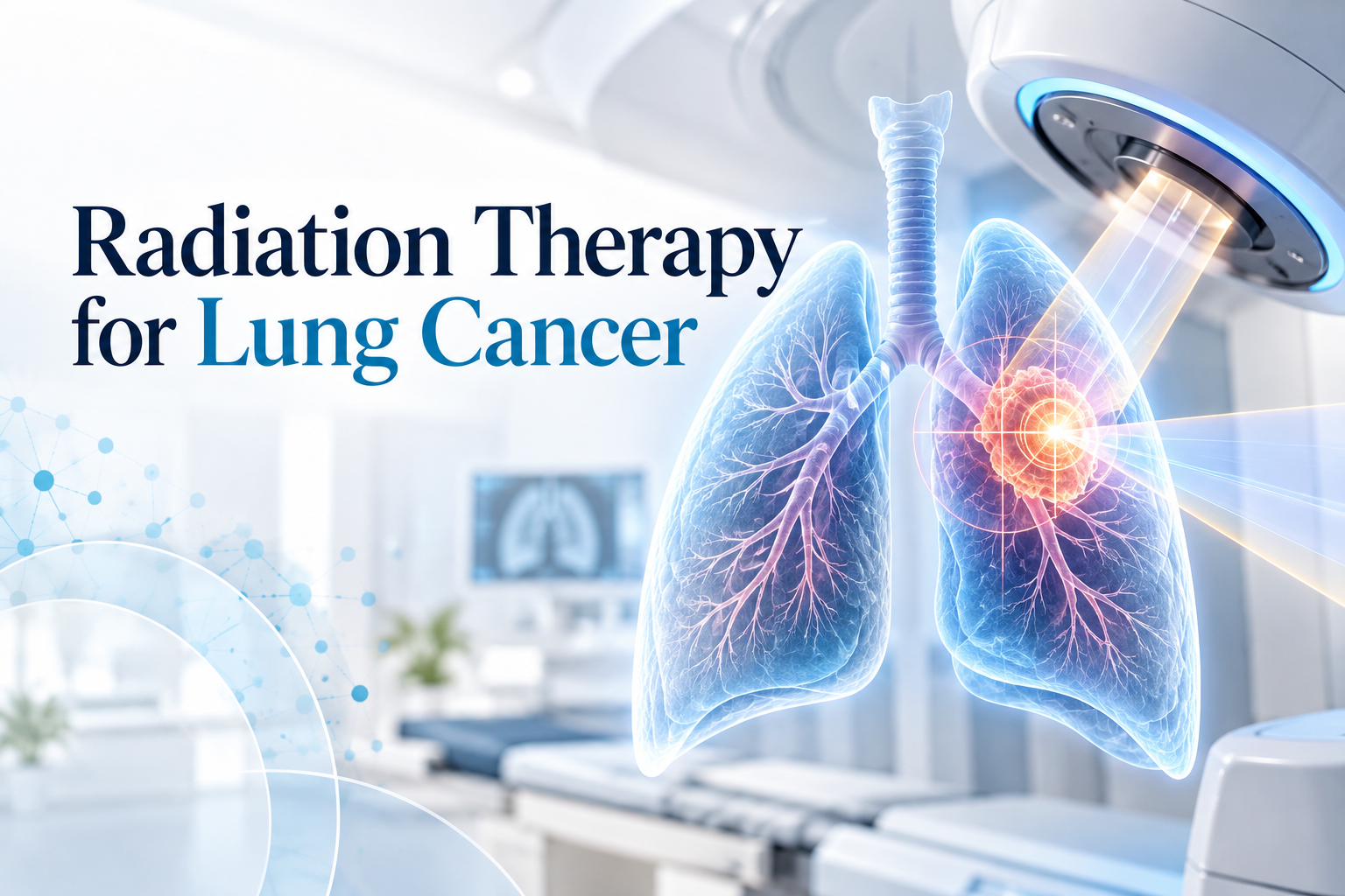 Radiation Therapy for Lung Cancer: When Is It Recommended?